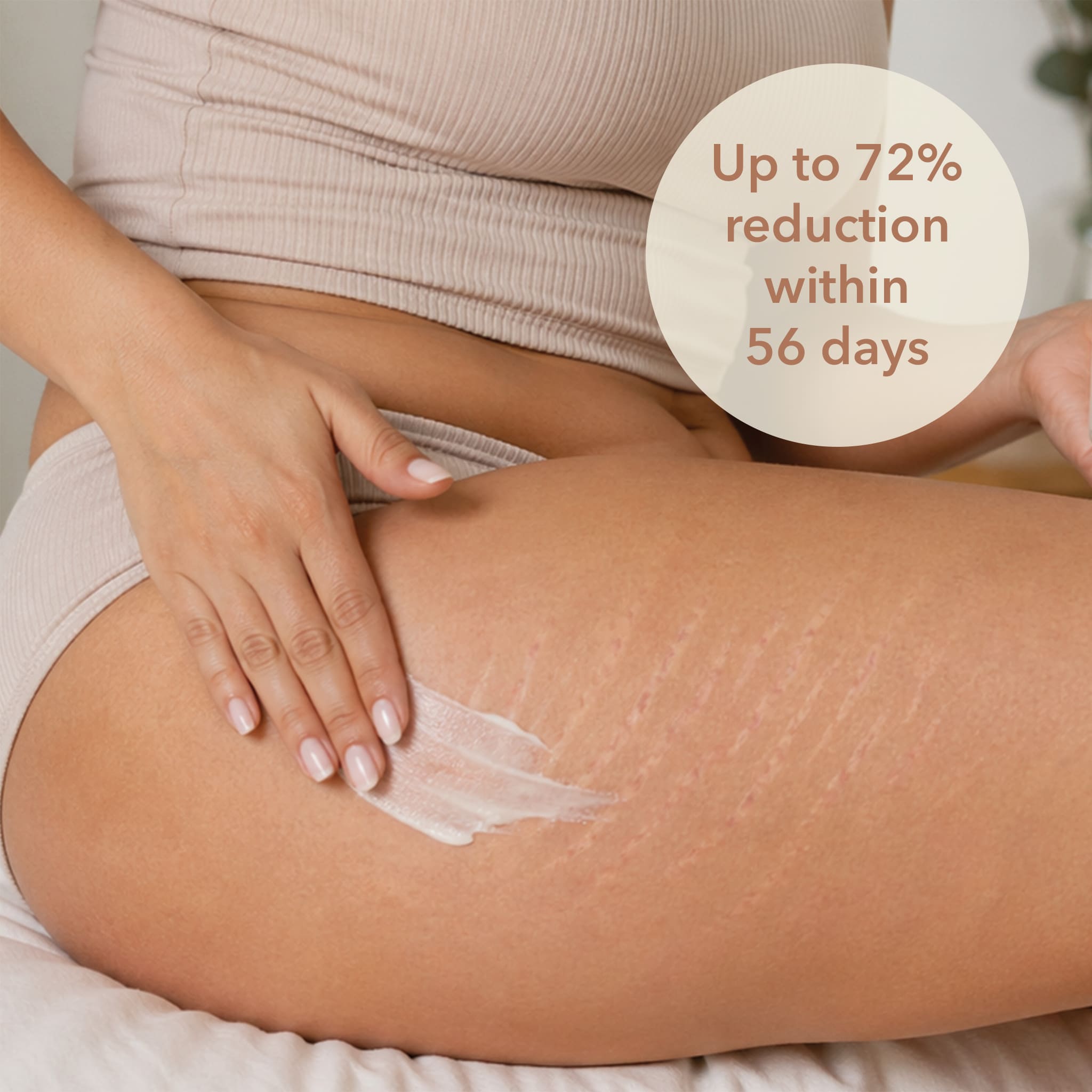 Woman putting body butter on her leg where stretch marks are present. Callout indicates Dionis Melt My Marks Body Butter has shown up to 72% reduction of stretch marks within 56 days of regular use.